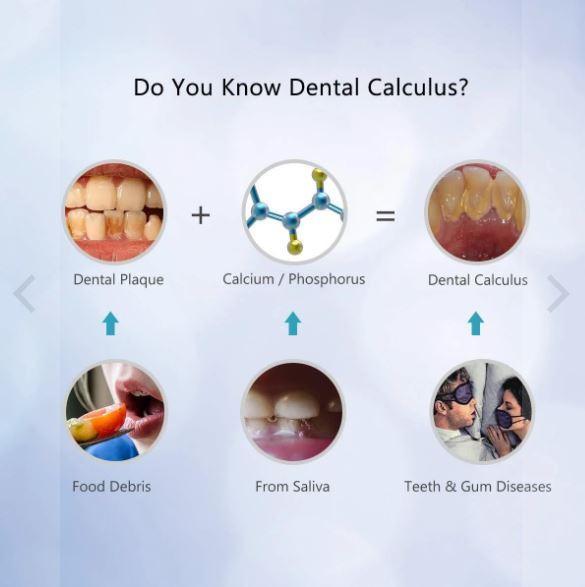 Ultrasonic Dental Plaque and Scaler Remover