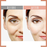 Eye Delight Boost Serum