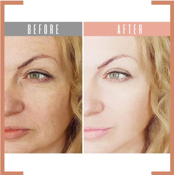 Eye Delight Boost Serum