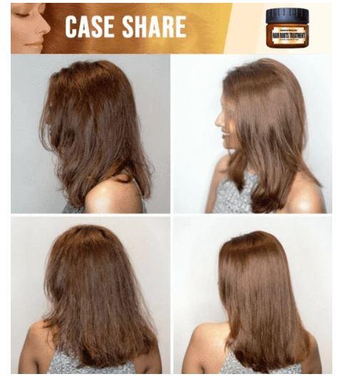 Miracle Hair Treatment