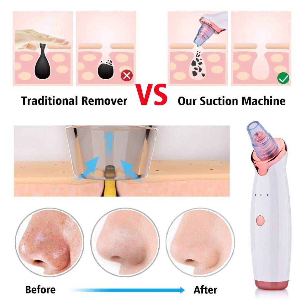 4 in1 Facial Cleansing Kit