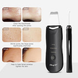 Ultrasonic Ion Deep Cleaning Skin Tool