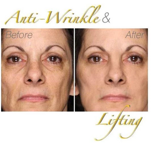24K Gold Peel-Off Mask