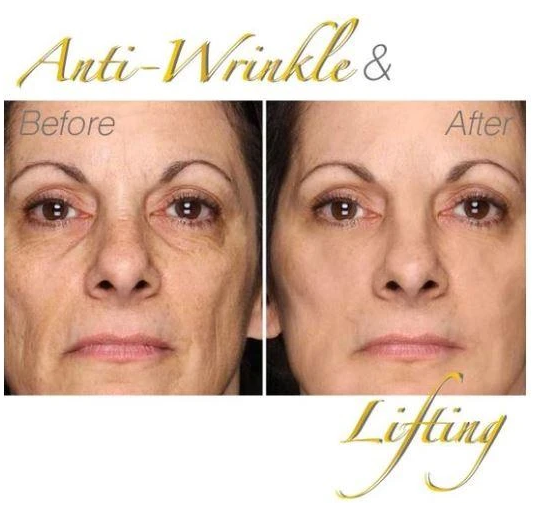 24K Gold Peel-Off Mask