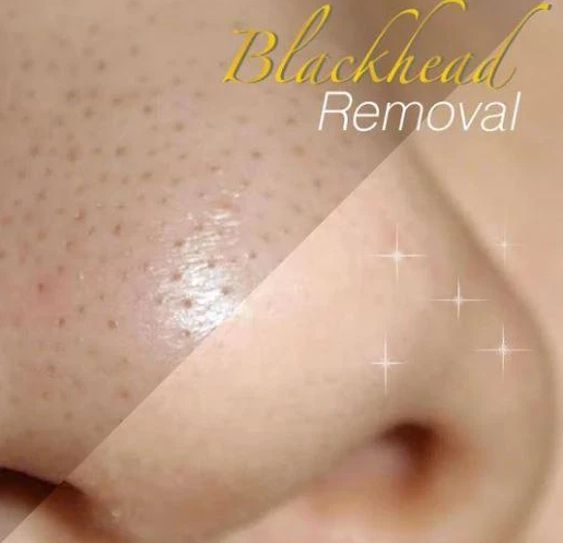 24K Gold Peel-Off Mask