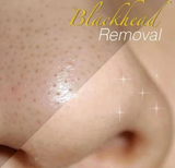 24K Gold Peel-Off Mask
